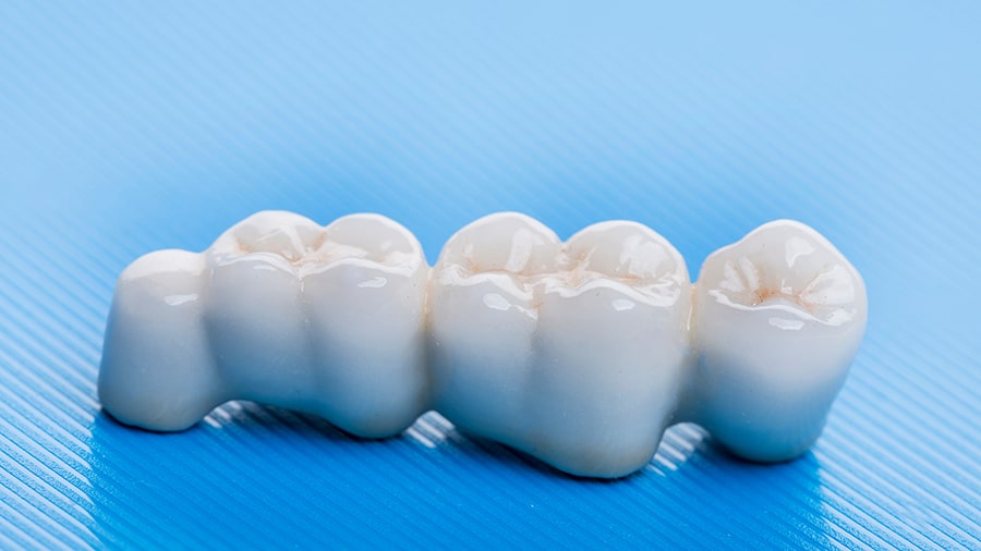 Fixed dental bridge Washington MI dentist